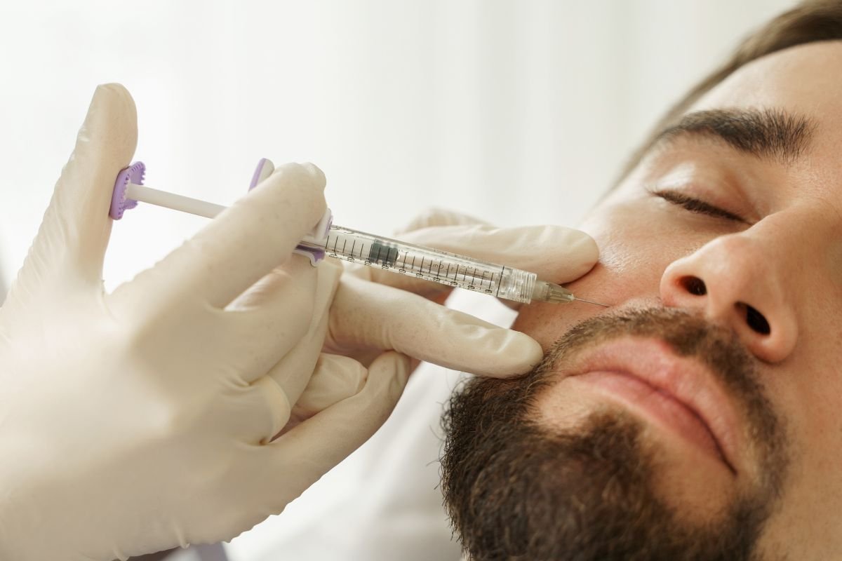 Principais indicações para o preenchimento facial