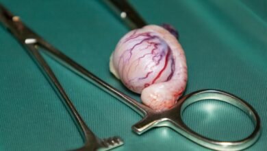 cirurgia no testículo