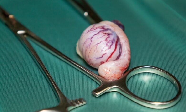 cirurgia no testículo
