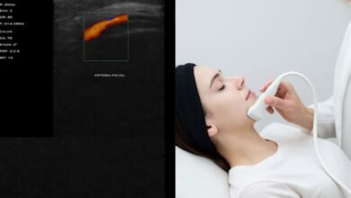 Mapeamento Facial com Ultrassonografia: Segurança Avançada na Harmonização Facial