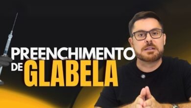 Quando o preenchimento da glabela é indicado