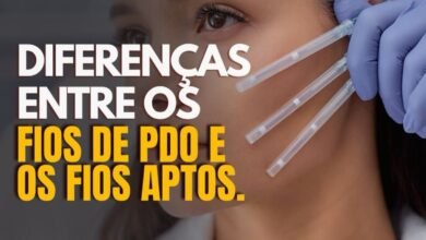 Diferença entre fios de PDO e fios Aptos: qual escolher para lifting facial?