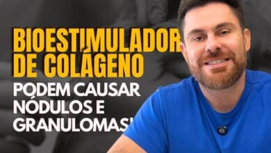 Bioestimuladores de colágeno podem causar nódulos e granulomas?