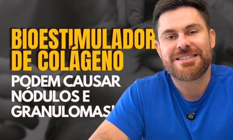 Bioestimuladores de colágeno podem causar nódulos e granulomas?