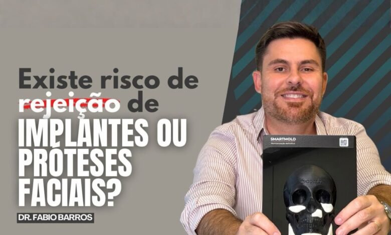 Existe risco de rejeição de implantes faciais?